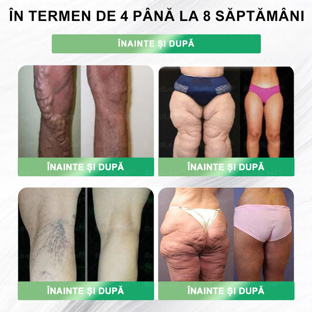 💖𝐂𝐞𝐫𝐭𝐢𝐟𝐢𝐜𝐚𝐫𝐞 𝐂𝐄|𝐁𝐮𝐢𝐥𝐝𝐋𝐞𝐚𝐟® 𝐆𝐋𝐏-𝟏 𝐒𝐨𝐥𝐮ț𝐢𝐞 𝐨𝐫𝐚𝐥ă 𝟖 î𝐧 𝟏 𝐅𝐢𝐭 & 𝐕𝐢𝐭𝐚𝐥 (𝐃𝐨𝐚𝐫 𝐨 𝐝𝐚𝐭ă 𝐩𝐞 𝐳𝐢, 𝐬𝐜𝐡𝐢𝐦𝐛ă𝐫𝐢 𝐯𝐢𝐳𝐢𝐛𝐢𝐥𝐞 î𝐧 𝟕 𝐳𝐢𝐥𝐞) ✅ 𝐏𝐞𝐧𝐭𝐫𝐮 𝐨𝐛𝐞𝐳𝐢𝐭𝐚𝐭𝐞, 𝐬ă𝐧ă𝐭𝐚𝐭𝐞𝐚 𝐜𝐚𝐫𝐝𝐢𝐨𝐯𝐚𝐬𝐜𝐮𝐥𝐚𝐫ă, 𝐝𝐢𝐚𝐛𝐞𝐭, 𝐚𝐩𝐧𝐞𝐞 î𝐧 𝐬𝐨𝐦𝐧, 𝐬ă𝐧ă𝐭𝐚𝐭𝐞𝐚 𝐢𝐧𝐭𝐞𝐬𝐭𝐢𝐧𝐞𝐥𝐨𝐫, 𝐩𝐫𝐨𝐛𝐥𝐞𝐦𝐞 𝐚𝐫𝐭𝐢𝐜𝐮𝐥𝐚𝐫𝐞 ș𝐢 𝐦𝐮𝐥𝐭𝐞 𝐚𝐥𝐭𝐞𝐥𝐞.